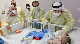 Conjoined Iraqi twins in stable condition after major surgery in Saudi Arabia