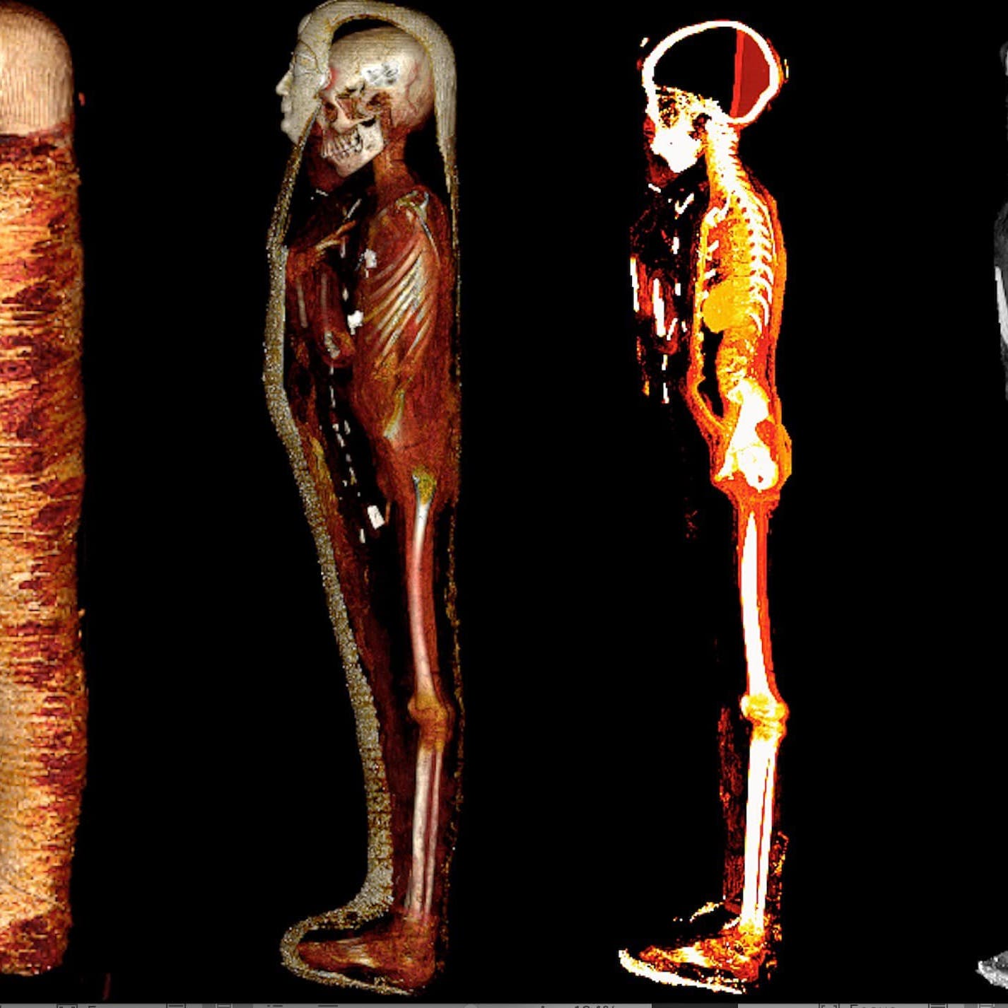 طفل ذهبي مصري عمره 2300 سنة.. علماء يكشفون مفاجآت داخل جثته المحنطة!