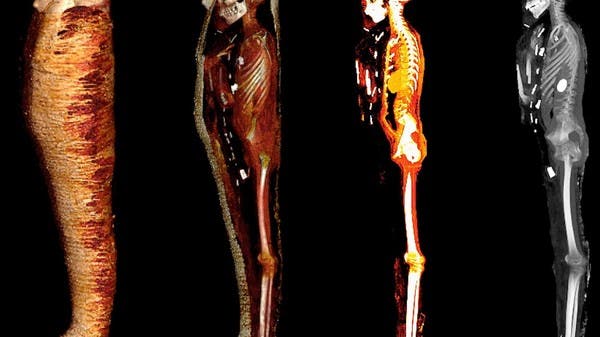 طفل ذهبي مصري عمره 2300 سنة.. علماء يكشفون مفاجآت داخل جثته المحنطة!