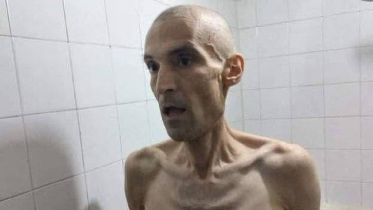 Images of emaciated Iranian prisoner on hunger strike prompt outrage