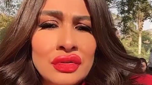 With big lips and shocking features.. Yasmine Abdelaziz surprised her followers