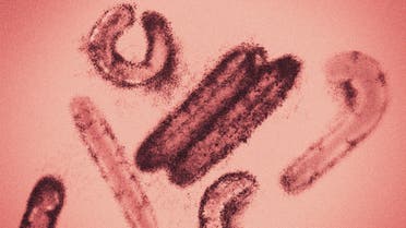 Colored visualisation of Marburg virus electron microscopy photo