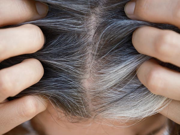 6 عوامل تتسبب بظهور الشعر الأبيض قبل أوانه.. هل تعرفونها؟