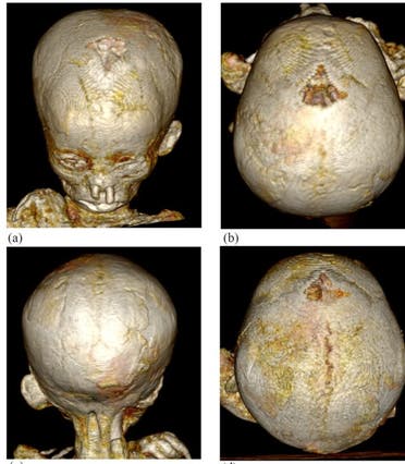 الصورة من . International Journal of Osteoarchaeology