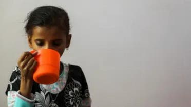 کودک یمنی دچار سوتغذیه