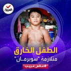 عالم غريب | يعاني من متلازمة نادرة.. طفل بعضلات مفتولة كلاعبي كمال الأجسام