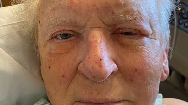 Elderly Man Hospitalized After Brutal Attack by Killer Bees