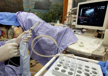 An employee demonstrates the preparation to take eggs with a needle at the e-Stork Reproductive Center. (Reuters)