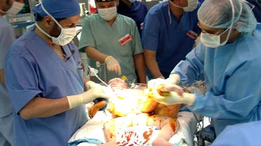 Saudi doctors perform surgery to a pair of Polish conjoined infant girls at King Abdul-Aziz Medical City, Riyadh January 3, 2005. (Reuters)