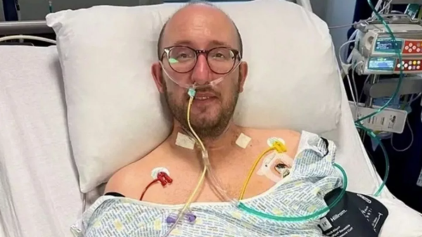 Scottish Man Thought He Had a Cold, but It Turned out to Be a Serious Condition: Sepsis