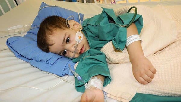 Siamese Twin “Bassam” Recovers After Successful Separation; Twin “Ehsan” Passes Away Due to Congenital Defects