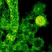 Δύο θάνατοι από MERS αναφέρθηκαν στη Σαουδική Αραβία, σύμφωνα με τον ΠΟΥ