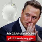 رقاقات ماسك ستزرع في أدمغة البشر قريباً