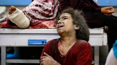 A young injured girl awaits treatment at the emergency ward of the Al-Shifa hospital following an Israeli strike, in Gaza City on November 5, 2023. (AFP)