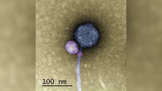 کشف دو ویروس «به‌‌هم چسبیده» برای اولین بار در تاریخ میکروبیولوژی