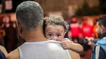 مشاهد من غزة - طفل مصاب يحمله أبوه - وكالات