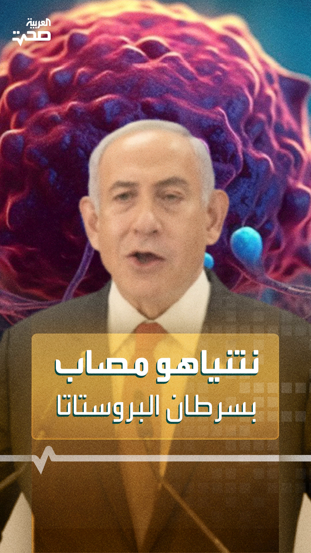 نتنياهو مصاب بسرطان البروستاتا نتنياهو مصاب بسرطان البروستاتا