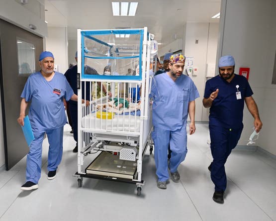 التوأم الطفيلي إلى طريقه غرفة العمليات 