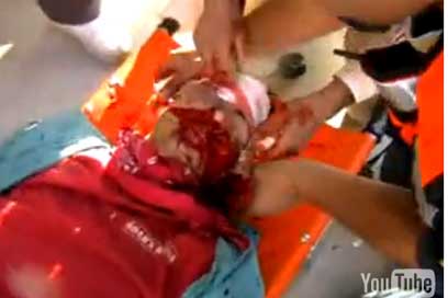US activist shot by Israeli soldier still critical
