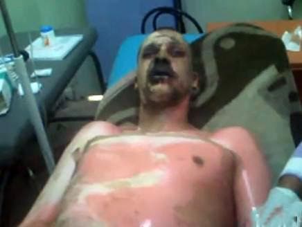 Algerian dies in self-immolation, echoing Tunisia
