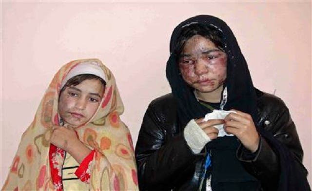 Afghan woman attacked with acid after refusing marriage