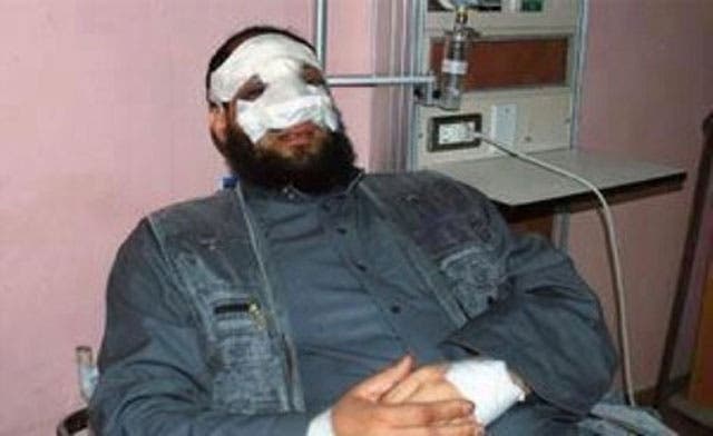 Egypt’s Islamist party sacks MP for getting a nose job