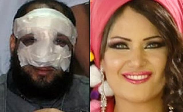 Egyptian actress files divorce lawsuit against ‘nose job MP’